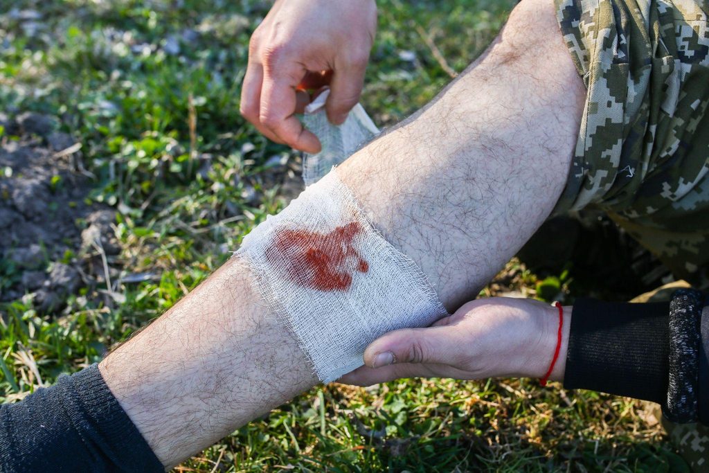 A person cleaning and bandaging a dog bite wound on their hand